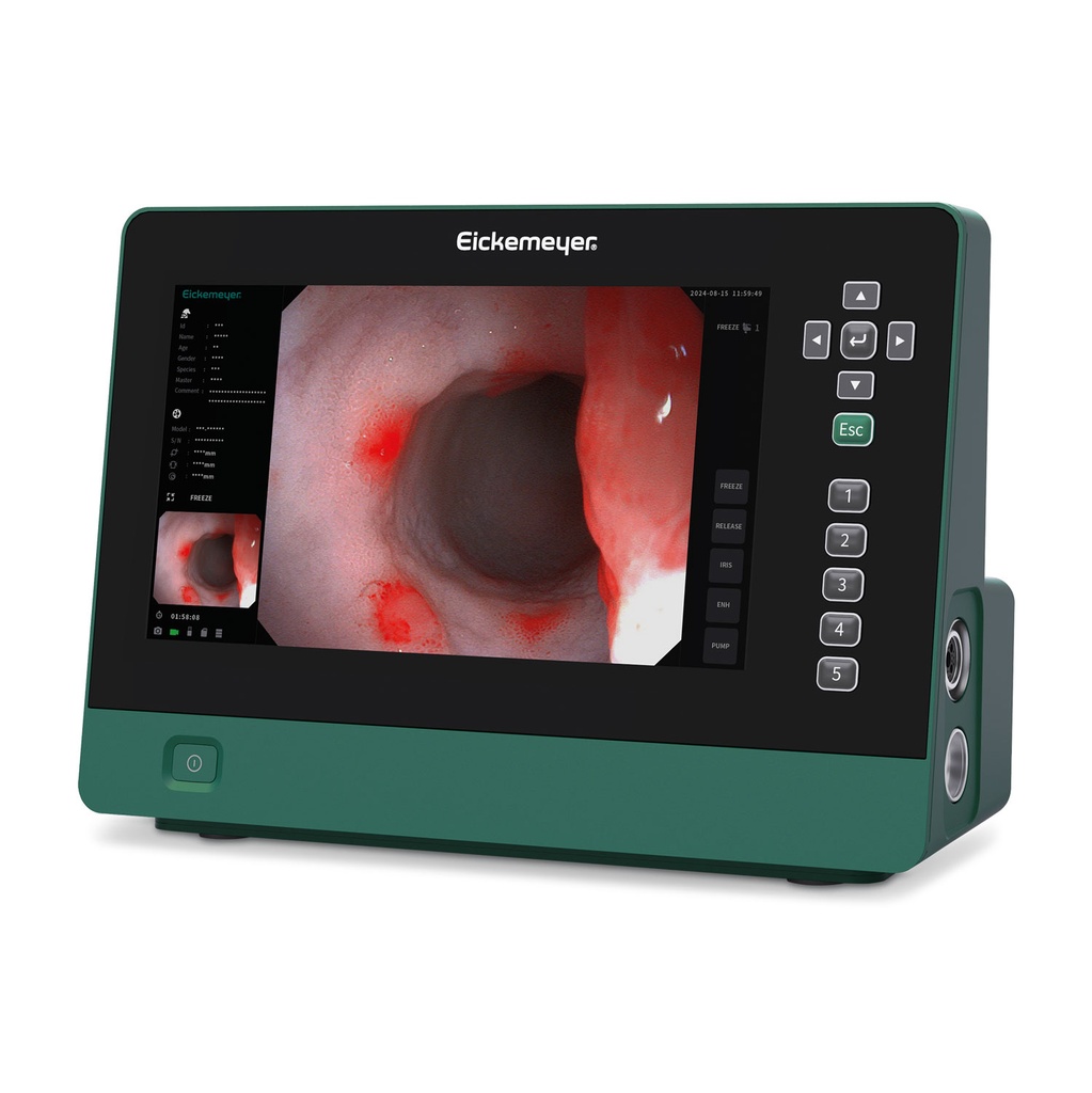 Endoskopsystem, EickView 5 i 1 1